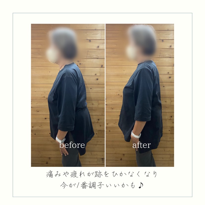 施術事例