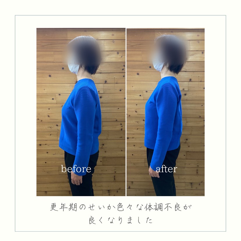施術事例