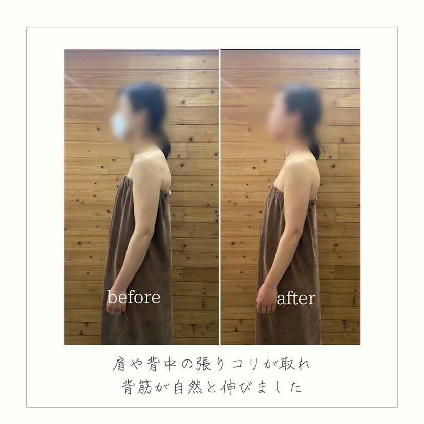 施術事例
