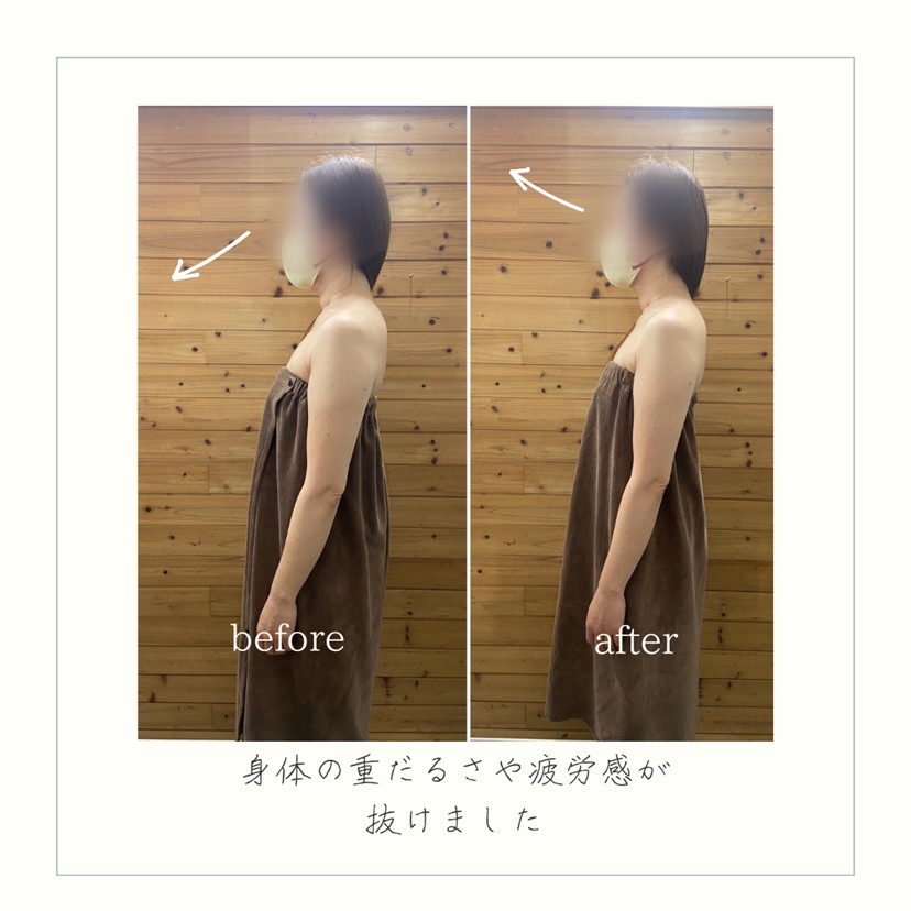 施術事例